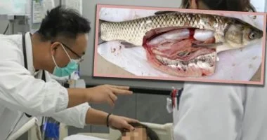 بين الخرافة والطب.. "مرارة سمكة" تضع خمسينية صينية على حافة الموت