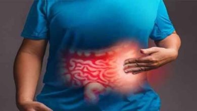 كنز في سوق الخضار.. فوائد الجرجير في التخسيس وعلاج مشاكل الهضم